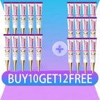 Mild Niacinamide Lightening Melasma Cream Effectively Fade Melanin Bleaching Cream Remove Dark Pigment Moisturizing Skin Care