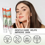 Body Acne Removal Cream Treatment Face Butt Back Acne Marks Smooth Repair Chicken Skin Cream Moisturizing Whitening Skin Care