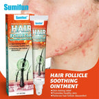 Body Acne Removal Cream Treatment Face Butt Back Acne Marks Smooth Repair Chicken Skin Cream Moisturizing Whitening Skin Care