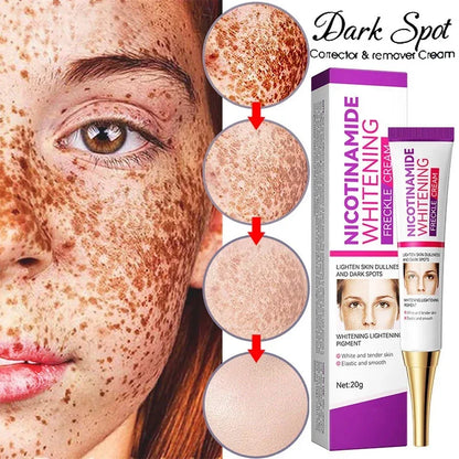 Mild Niacinamide Lightening Melasma Cream Effectively Fade Melanin Bleaching Cream Remove Dark Pigment Moisturizing Skin Care