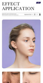 Mild Niacinamide Lightening Melasma Cream Effectively Fade Melanin Bleaching Cream Remove Dark Pigment Moisturizing Skin Care